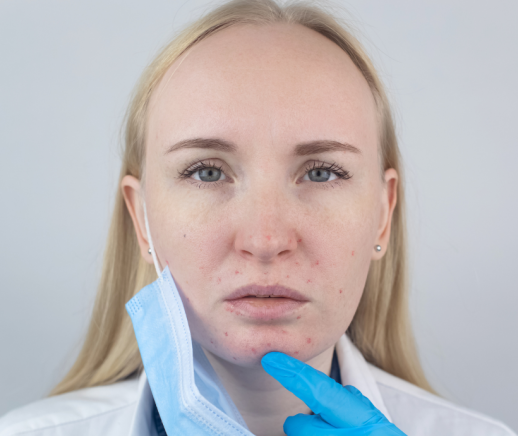 Woman with facial irritation removing a face mask.